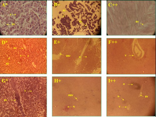 Histological photomicrograph of control and diazinon affected liver tissues of three fish species; A-C = <em>C. punctatus</em>; D-F = <em>H. fossilis</em>; G-I = <em>A. testudineus</em>; * = control; + = 20 mg/l; ++ = 25 mg/l concentration; S= sinusoids; BV= blood vessel; RS= rupture of sinusoids; BD= bile duct; DBV= destruction of bile duct; H= hemorrhage; V= vacuole; IRBV= irregular blood vessel; N= necrosis.