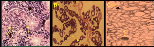 Histological photomicrograph of control and diazinon affected kidney tissues of three fish species; A-C = <em>C. punctatus</em>; D&amp;E = <em>H. fossilis</em>; F&amp;G = <em>A. testudineus</em>; * = control; + = 20 mg/l; ++ = 25 mg/l concentration; BC= bauman’s capsule; RT= renal tubule; BV= blood vessel; G= glomerulus; H= hemorrhage; N= necrosis