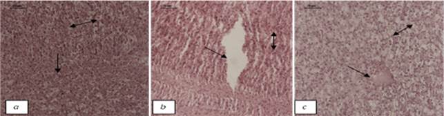 Transverse sections of H. fossilis liver at pH 7±0.5 after 36 hour-H&E-40X (a) Control: Normal hepatocytes (single headed arrow); Sinusoids (double headed arrow) (b) Copper treated: Degradation of cellular hepatocytes (single headed arrow); sinusoids with pyknotic nuclei (double headed arrow) (c) Cadmium treated: Necrosis (single headed arrow); Sinusoids (double headed arrow)